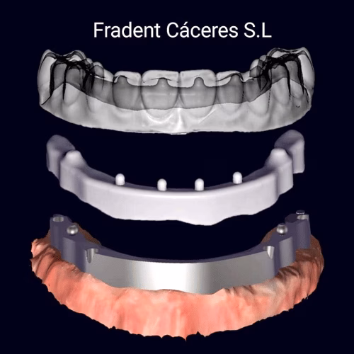 3D: La Evolución de la Odontología Moderna