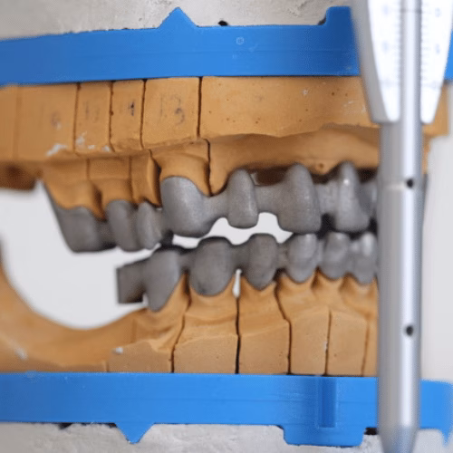 Servicios Dentales Mecanizados